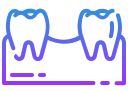 ponte su impianti e denti naturali